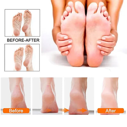Rechargeable Electric Foot File 1+10 Set Callus Remover Machine Pedicure Device Foot Care Tools For Heels Remove Dead Skin black